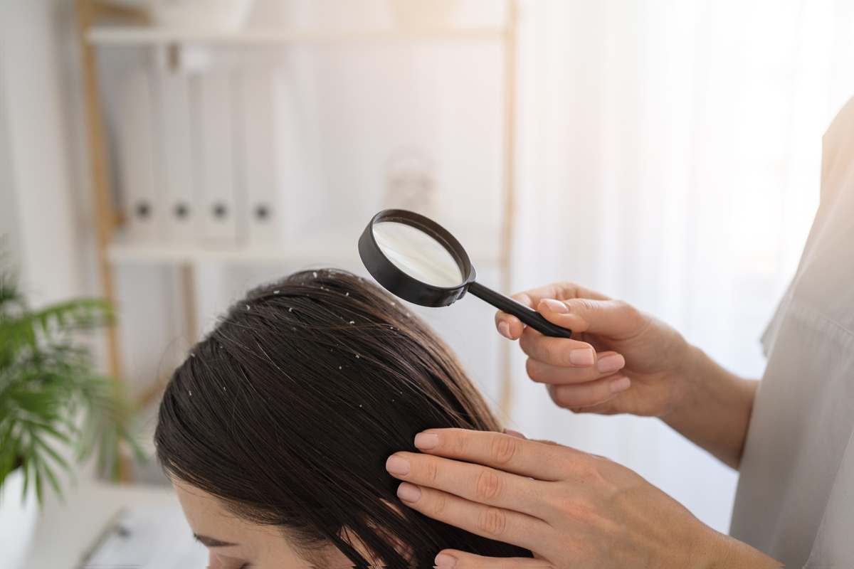 O que significa couro cabeludo descamando? Veja como resolver