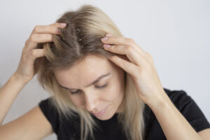 O que significa couro cabeludo descamando? Veja como resolver